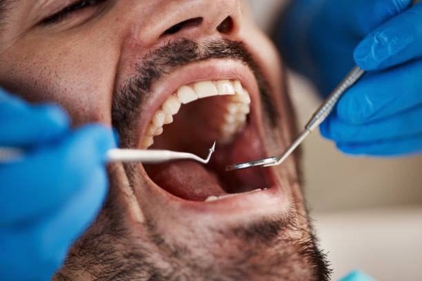 Best Emergency Gum Treatment in Laguna Heights, TX