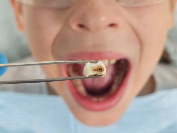 Best Pediatric Emergency Dentist in Laguna Heights, TX